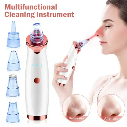 Vacuum Blackhead Remover Face Black Spots Cleaner White Dot Pimple Removal